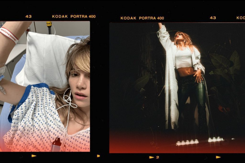 Σούκι Γουότερχαους: Νοσηλεύεται με κήλη από στενό παντελόνι η σύντροφος του Ρόμπερτ Πάτινσον