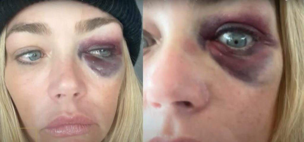 Οι ξυλοδαρμοί, οι ουσίες και οι εξωσυζυγικές σχέσεις: Τι απάντησε ο Άαρον Φάιπερς στις κατηγορίες της Ντενίζ Ρίτσαρντς