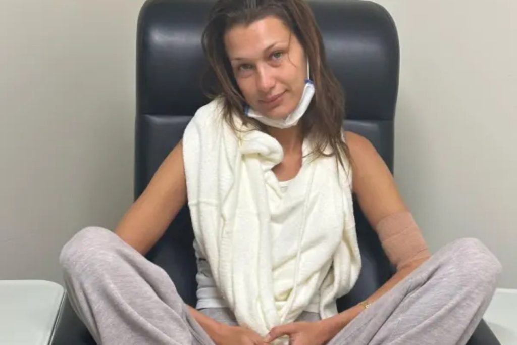 «Αόρατη αναπηρία» – Η Μπέλα Χαντίντ μιλάει για τη διαρκή «ιατρική ανησυχία» της μάχης της με τη χρόνια νόσο του Lyme