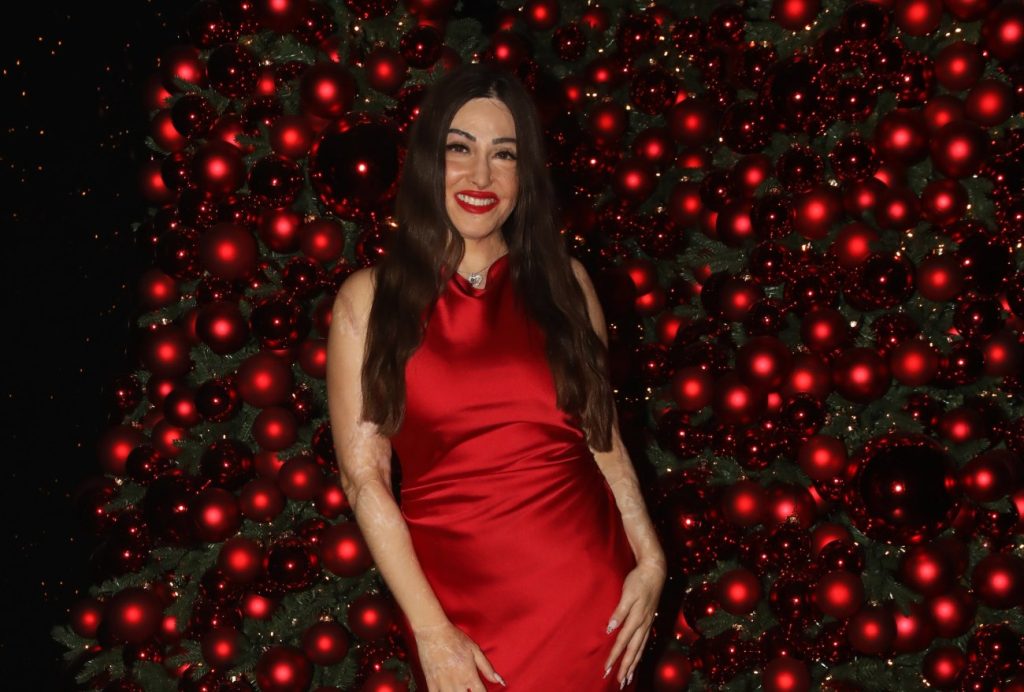 Ιωάννα Παλιοσπύρου: Συνεχίζει τις επεμβάσεις στο εξωτερικό